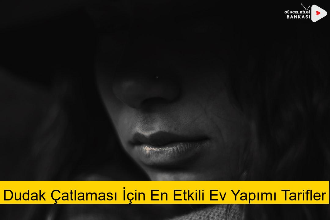 Dudak Çatlaması İçin En Etkili Ev Yapımı Tarifler