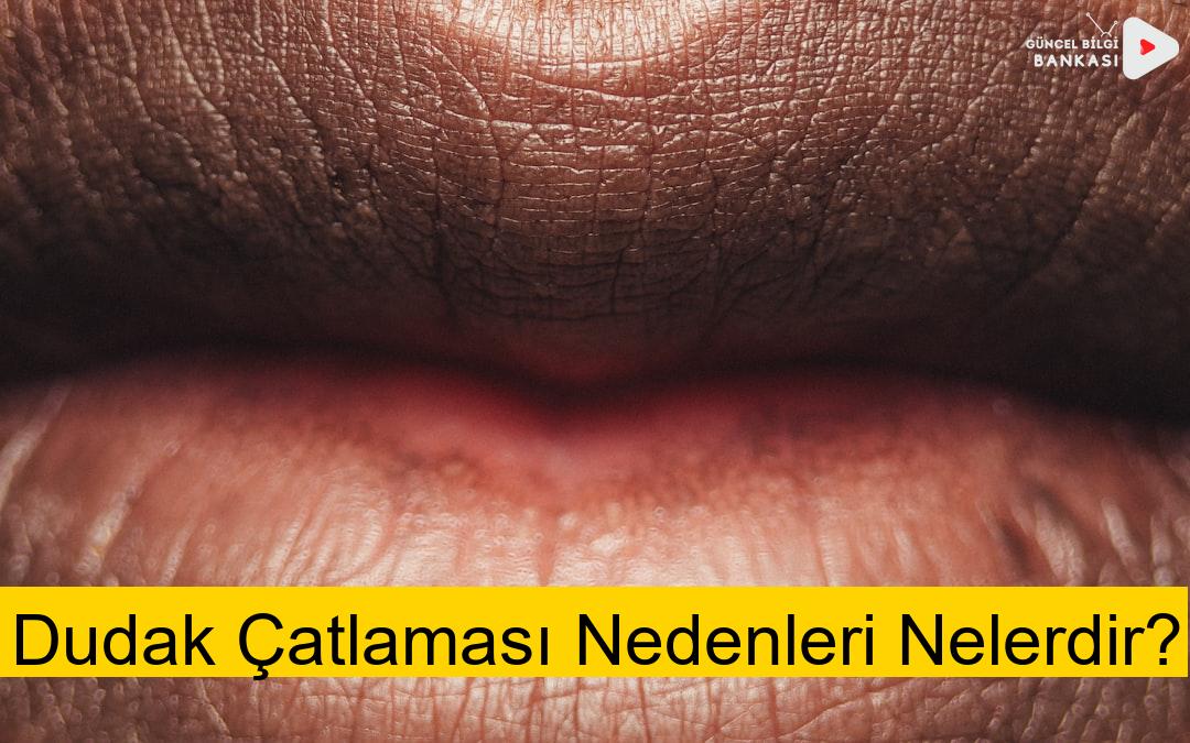 Dudak Çatlaması Nedenleri Nelerdir?