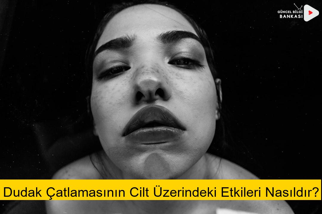 Dudak Çatlamasının Cilt Üzerindeki Etkileri Nasıldır?