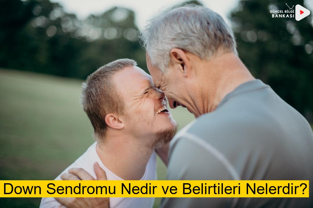 Down Sendromu Nedir ve Belirtileri Nelerdir?
