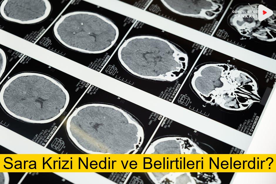 Sara Krizi Nedir ve Belirtileri Nelerdir?